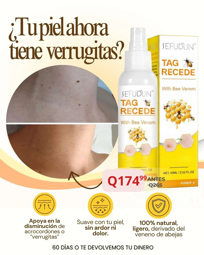 TAG RECEDE