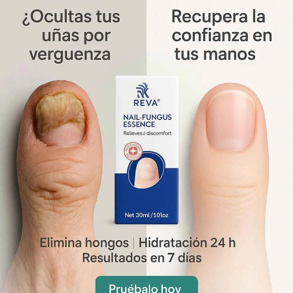 NAIL FUNGUS ESSENCE (Copia)