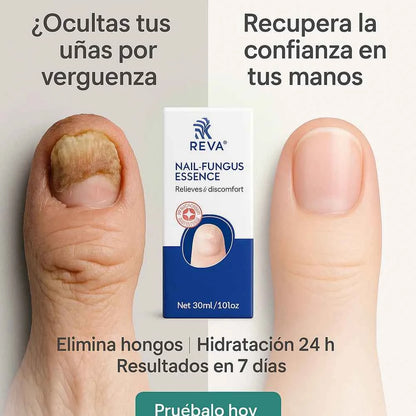 NAIL FUNGUS ESSENCE (Copia)