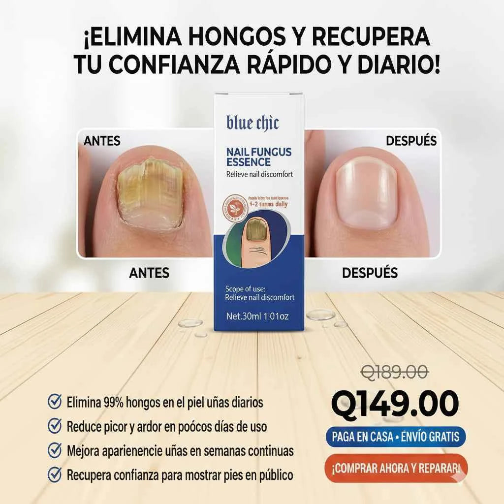 NAIL FUNGUS ESSENCE (Copia)
