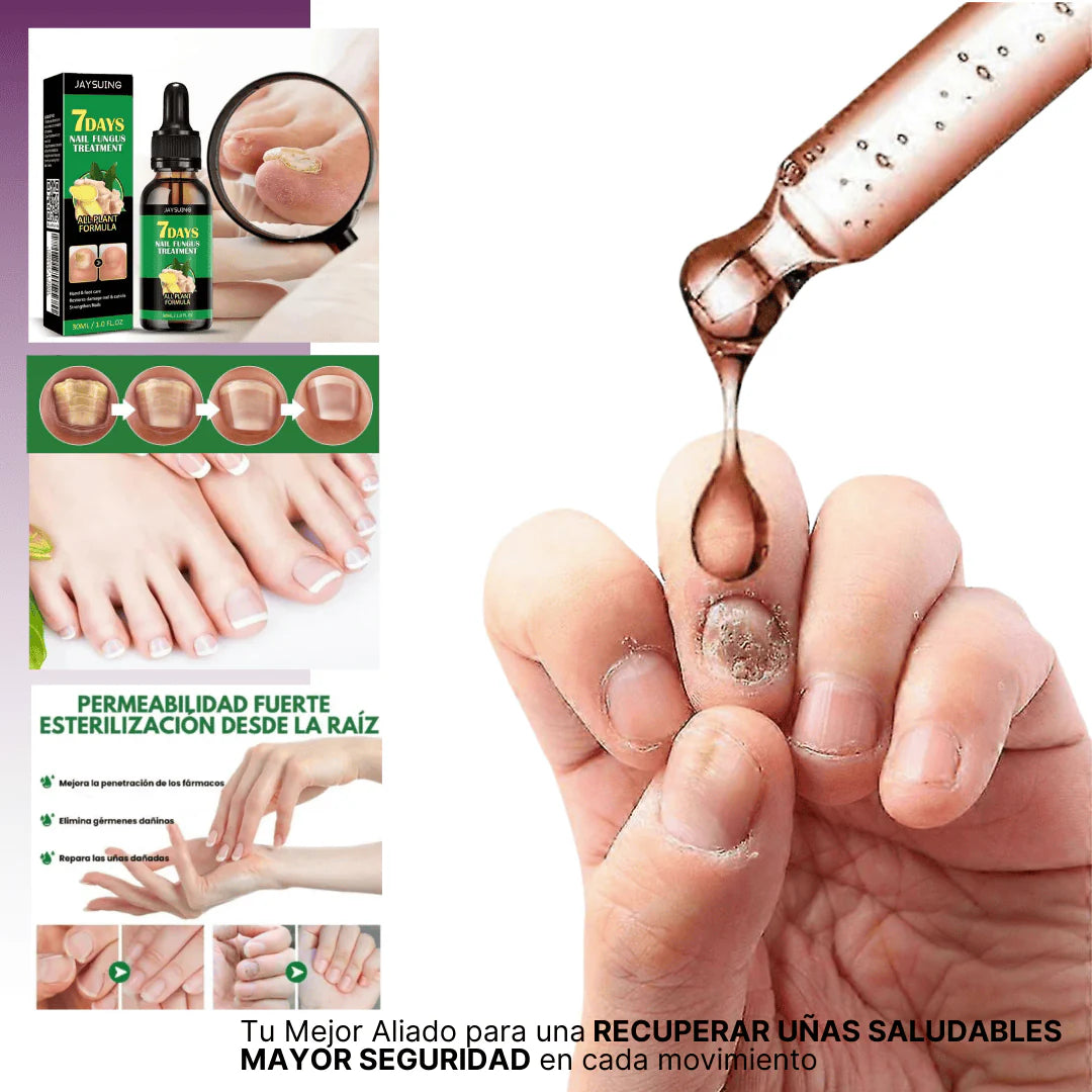7 Days Fungus Free Nails® - Protege y elimina el hongo de tus Uñas (50ml)